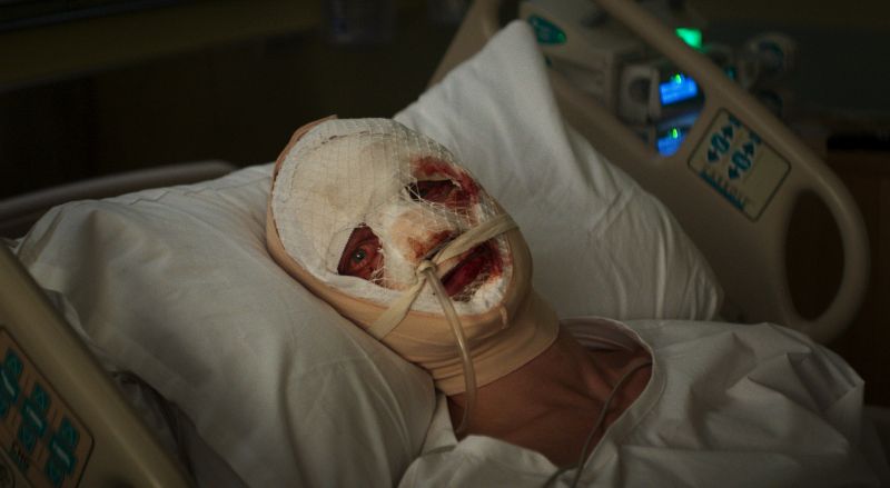 Tragedia y Desfiguración de Matt Hagen Matt Hagen acostado en una cama de hospital con el rostro completamente vendado y ensangrentado tras sufrir la agresión que arruinó su carrera.
